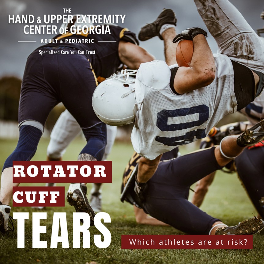 The Hand - ROTATOR CUFF TEARS | Why are they common sports injuries ...