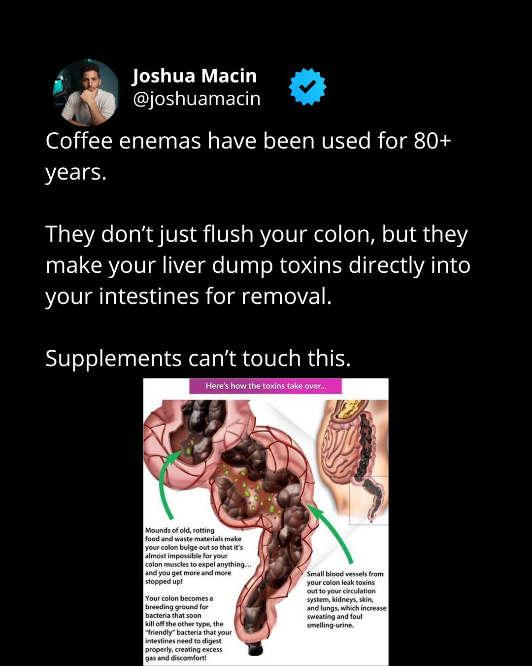 coffee enema glutathione study Should you try a enema? 🤨 #health #wellnesstrends #doctorreacts bpc 157 intramuscular bioavailability 暗黃色斑 Uneven Tone Pack:10 gm Sachet