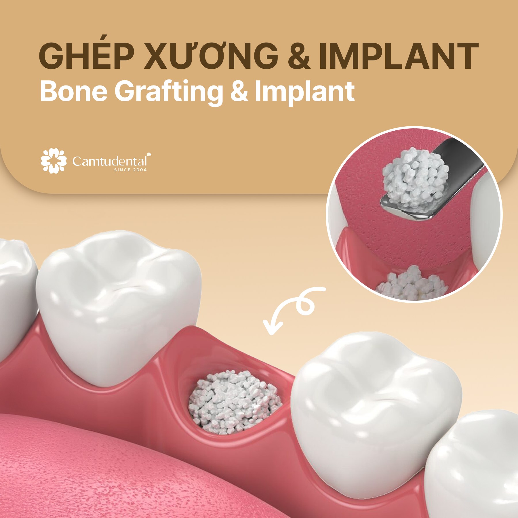 Camtu Dental - Nha khoa... - Camtu Dental - Nha khoa Cẩm Tú