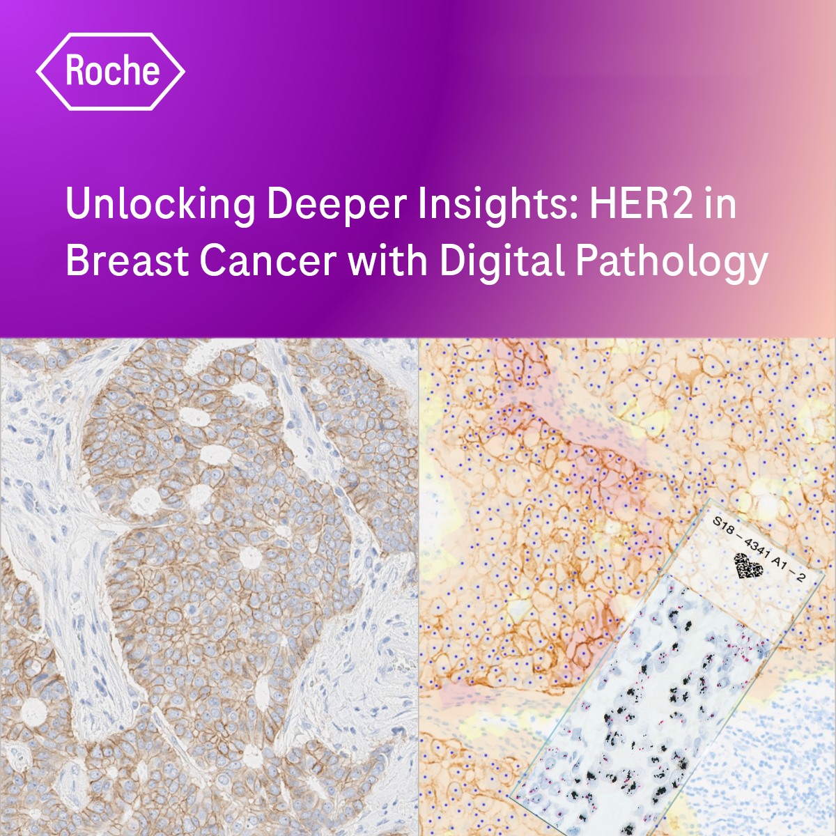Roche - Ever wondered how digital pathology is changing the game in ...