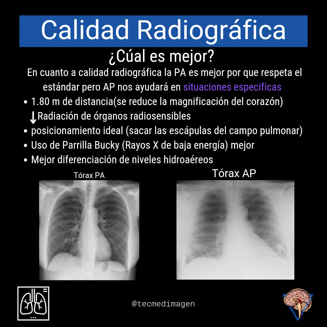Tórax Pa vs Tórax ap.... - Tecnologia Medica-Imagenologia | Facebook