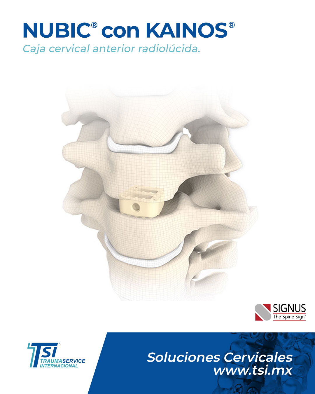 El relleno KAINOS®... - Traumaservice Internacional SA de CV | Facebook