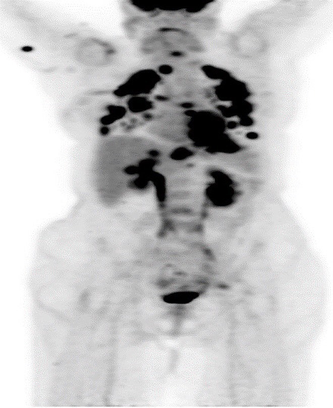 Elderly... - Nuclear Medicine & Molecular Oncologic Imaging | Facebook