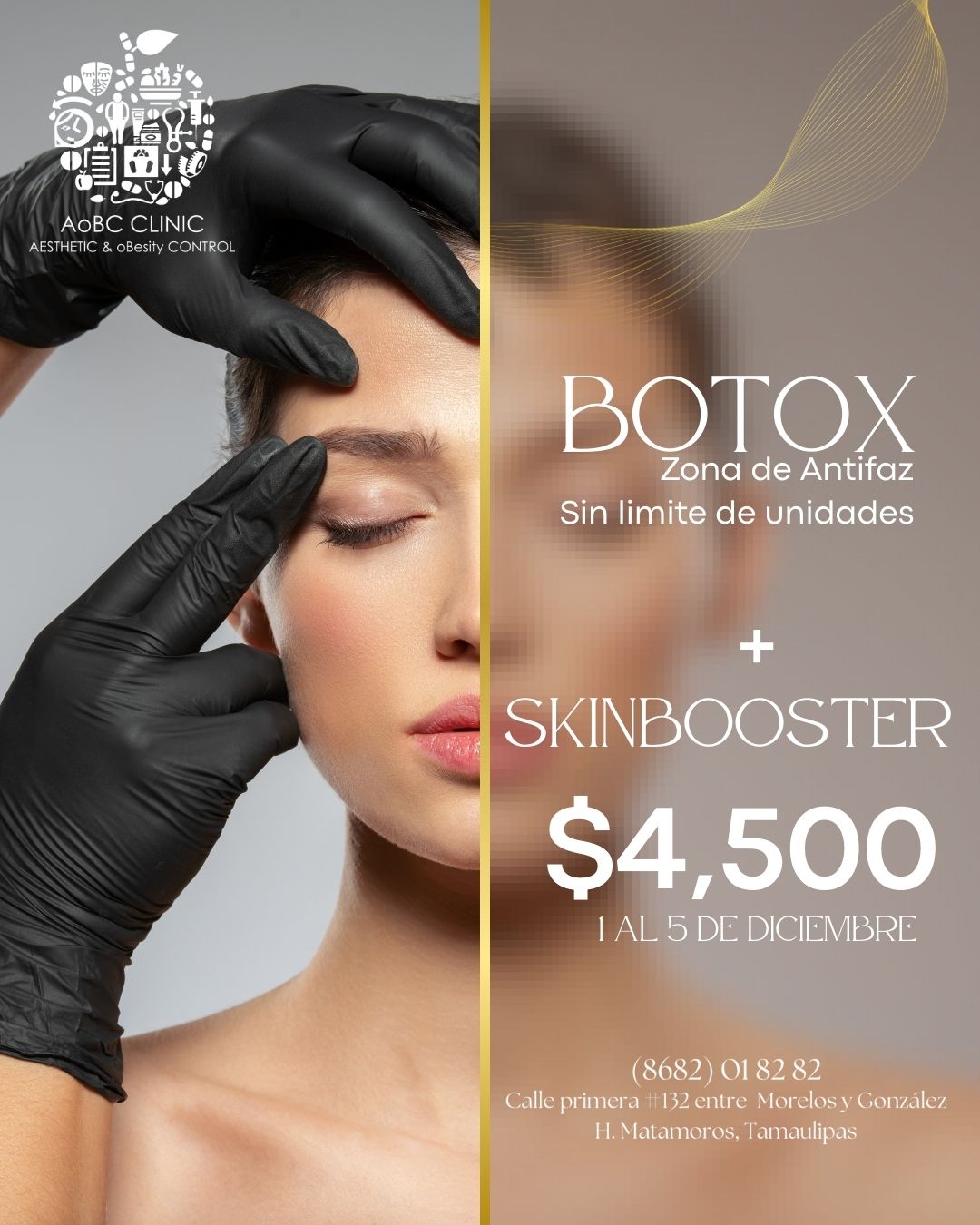 Aesthetic - PROMO 1 AL 5 DE DICIEMBRE 💉 Botox + 💧 Skinbooster Todo por ...