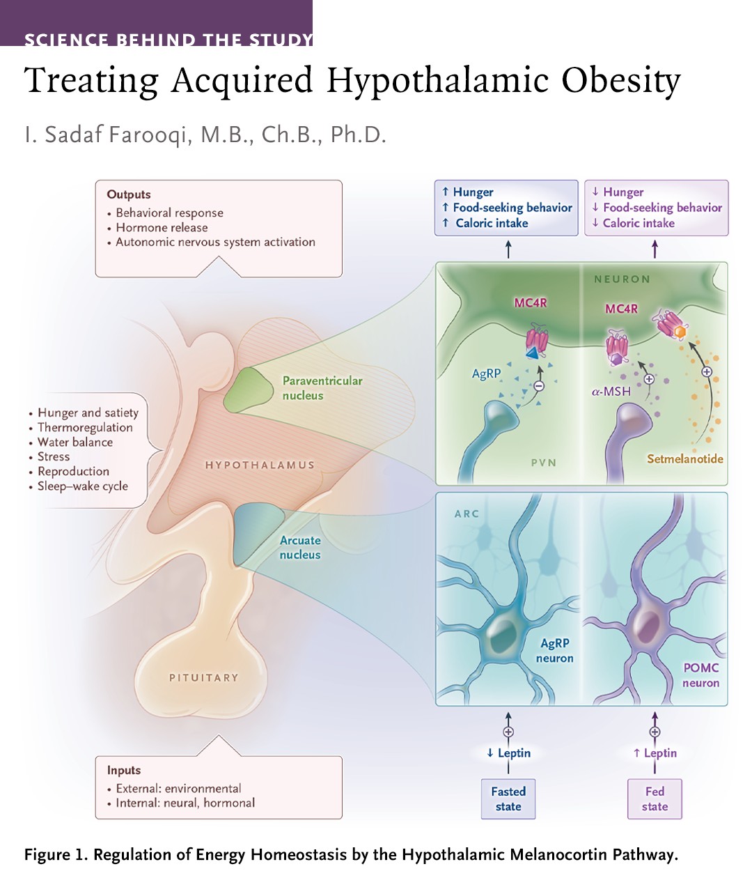 In a new Science behind the Study, I. Sadaf Farooqi, MB, ChB, PhD, describes the scientific basis for a trial of an MC4R agonist in persons with acquired hypothalamic obesity. Those who