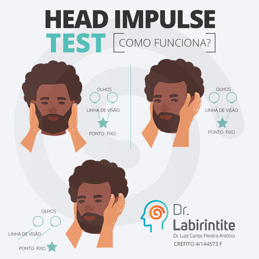 O Head Impulse Test... - Luiz Carlos Antônio - Fisioterapeuta | Facebook
