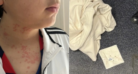 KOLO - An Albuquerque family is suing after they said they got beg bug ...