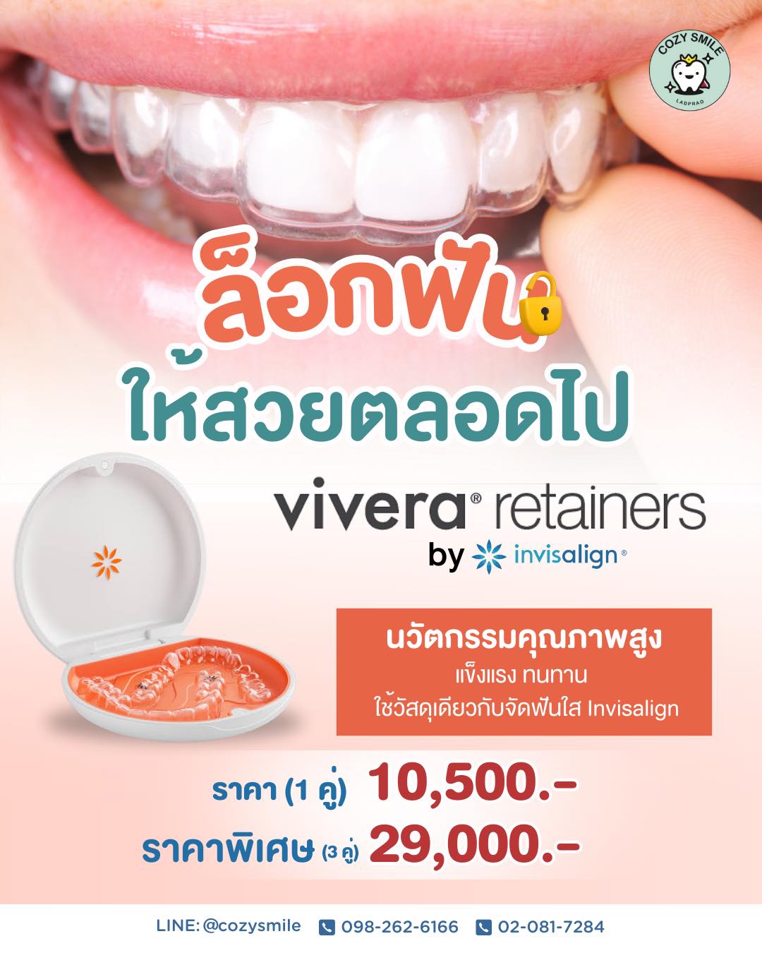 จัดฟัน - ล็อกฟันให้สวย…ตลอดไป ด้วย Vivera Retainers by Invisalign® รีเท ...