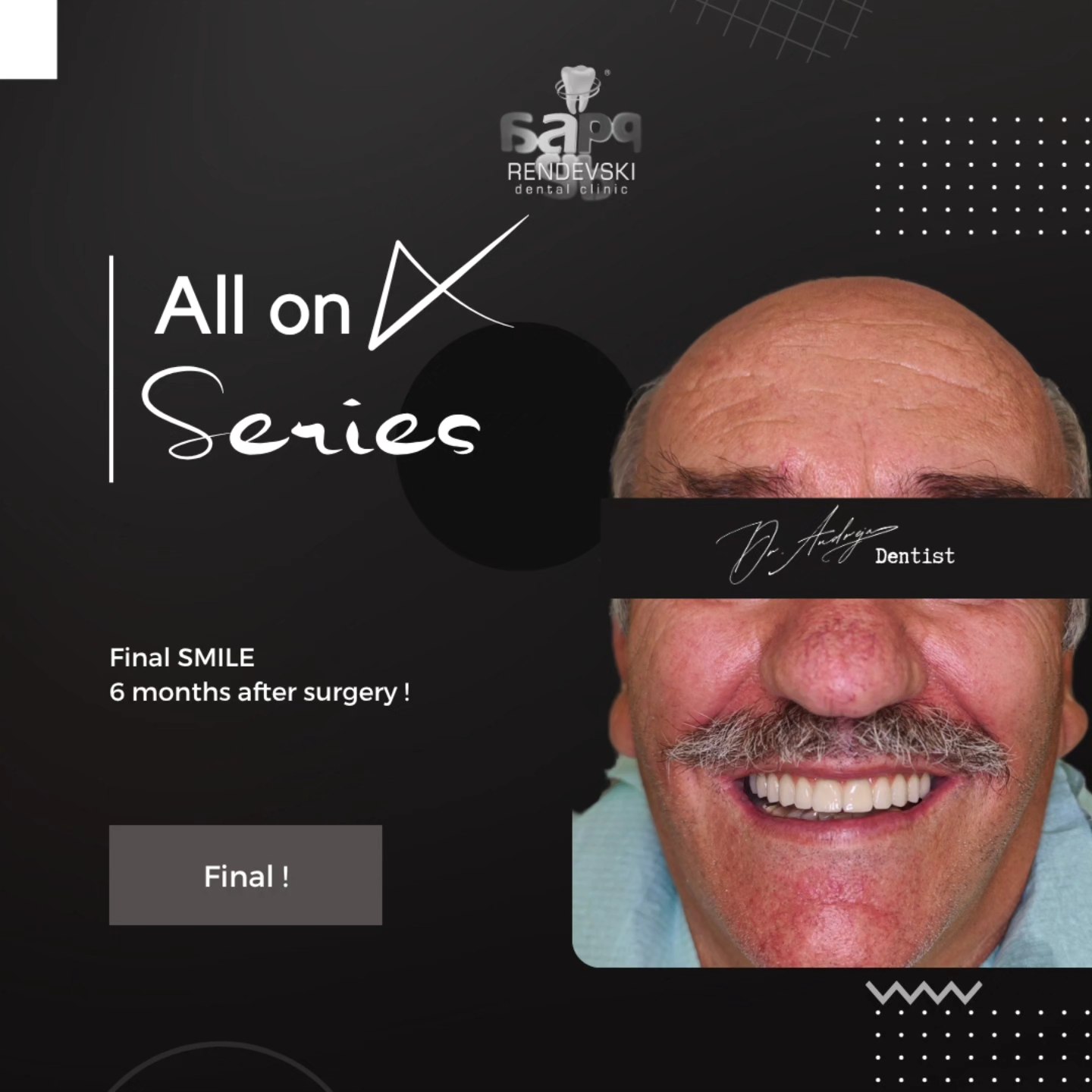 RENDEVSKI Dental Clinic added a... - RENDEVSKI Dental Clinic