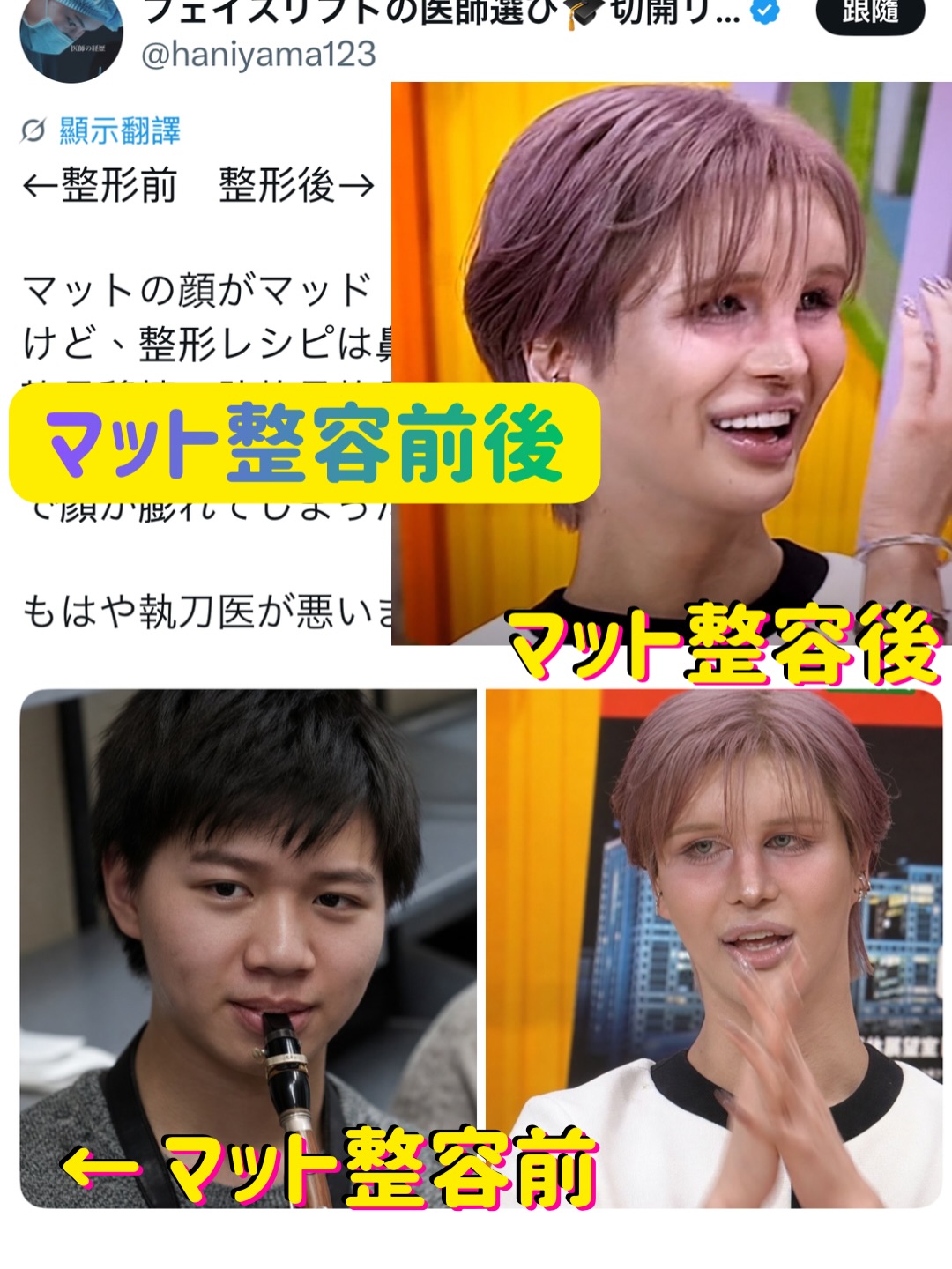 まっ と 整形 前