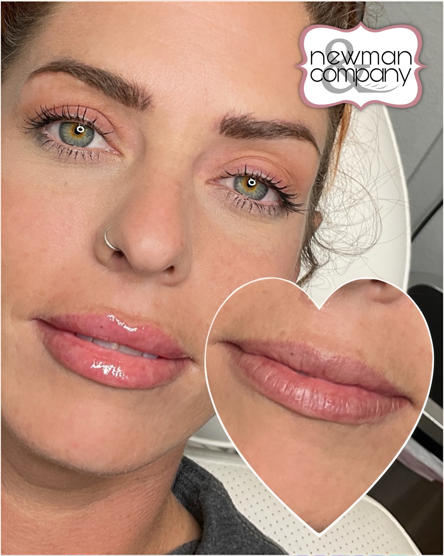One Word… Smooth iykyk ☺️ If you've been considering Lip Filler, let's get you in for a consultation. 📱(830)620-8444 🔗Booking Link in Bio 🌐 https://newmancmpy.com/lip-filler-at-newman-co/ Lip Filler in New Braunfels, TX #lipfillernewbraunfels #