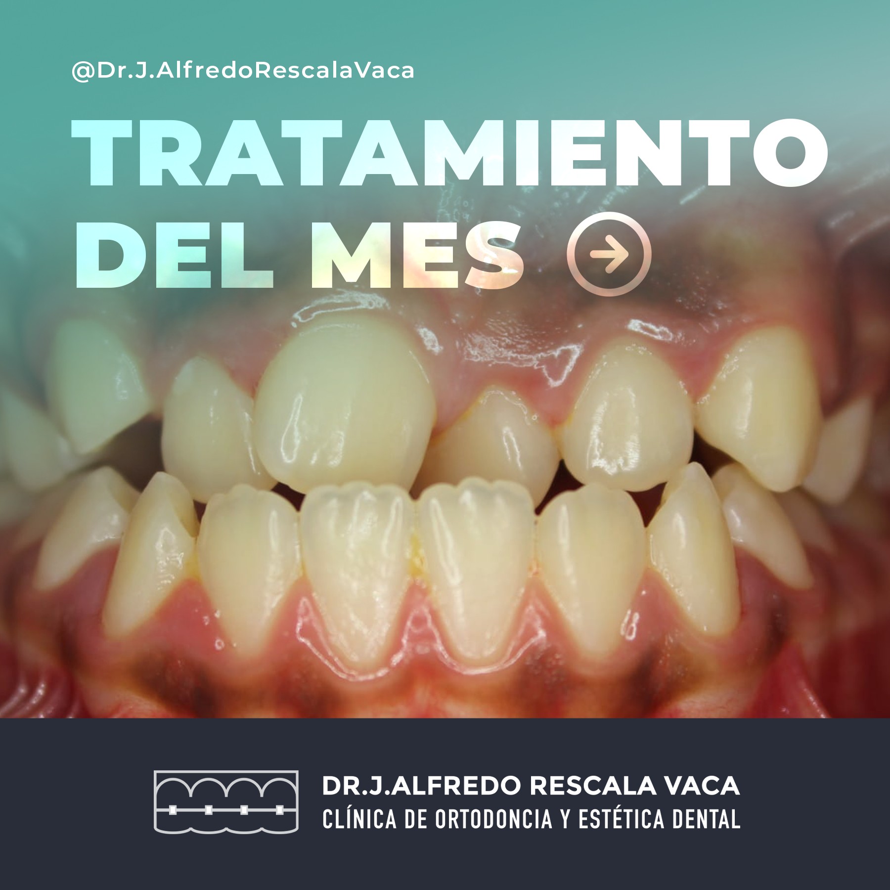 BENEFICIOS DE LA... - Dr. J. Alfredo Rescala Vaca | Facebook