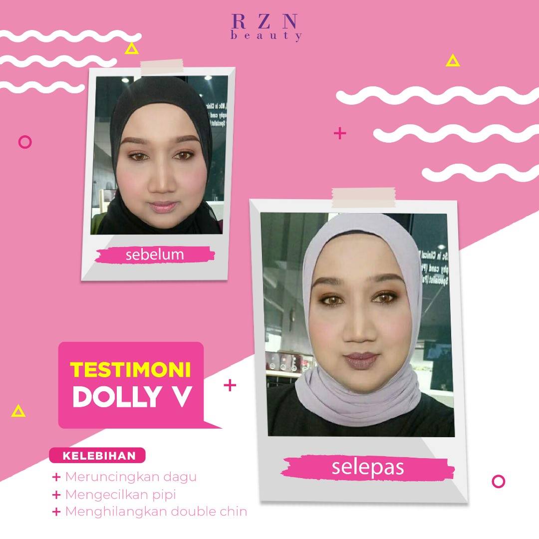 Testimoni Banyaknya Dolly V Shape Mask By Rzn Beauty Hq فيسبوك