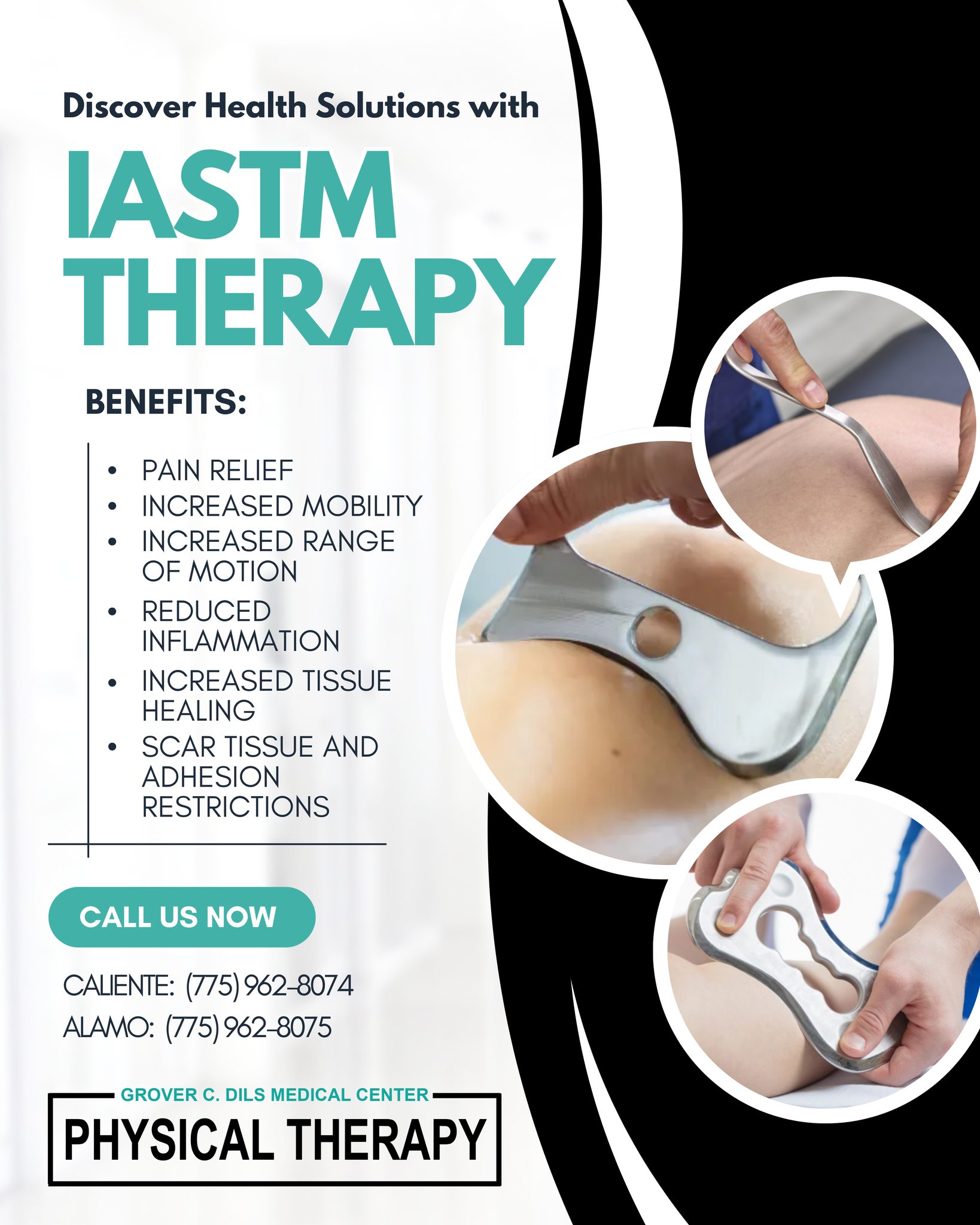 Grover - Instrument Assisted Soft Tissue Mobilization is a manual ...