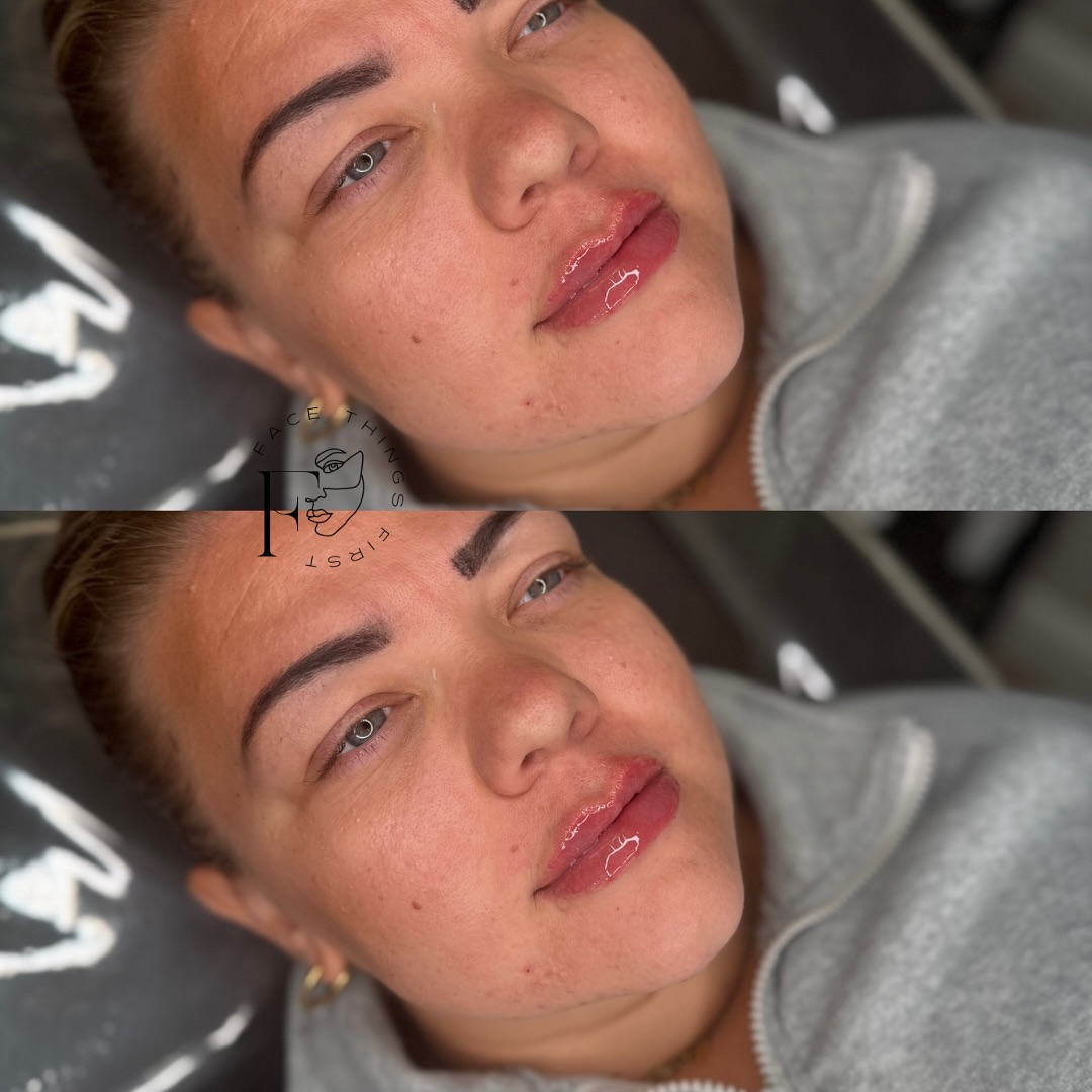 Face Things First | Rotherham
