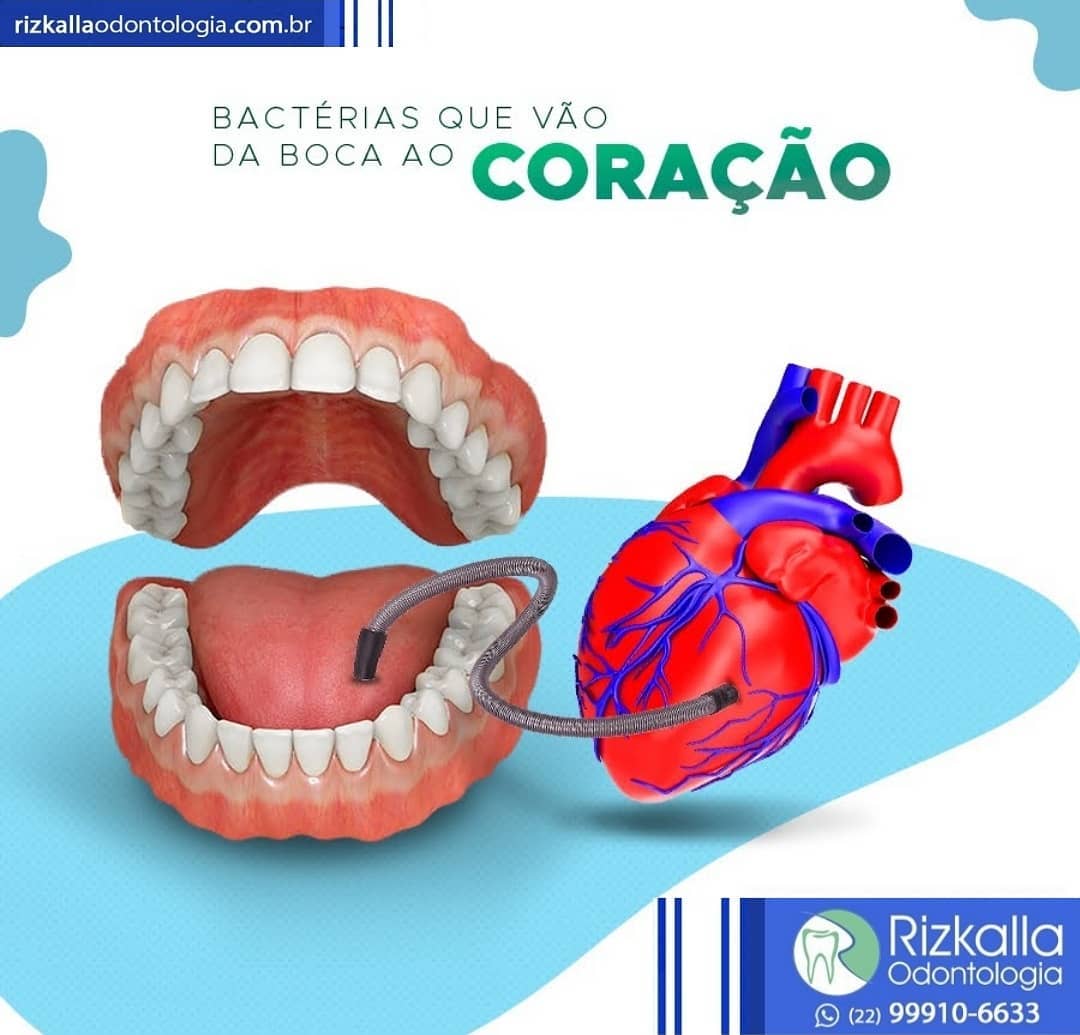 🔊 A endocardite bacteriana é o nome... - Rizkalla Odontologia