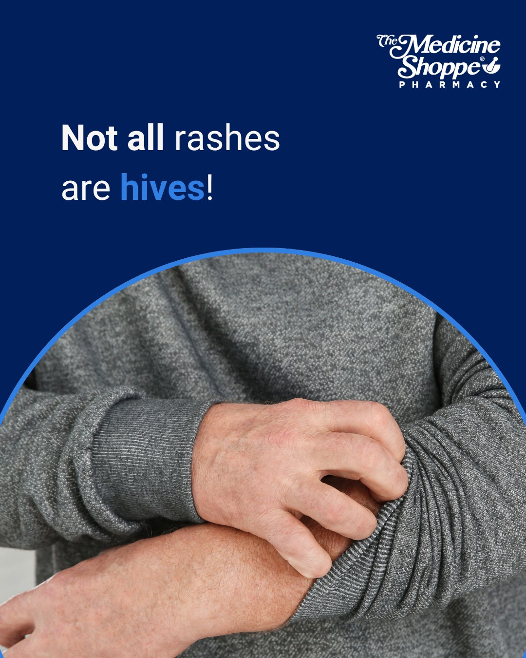 Medicine - Hives are a specific type of rash, and not all rashes are ...