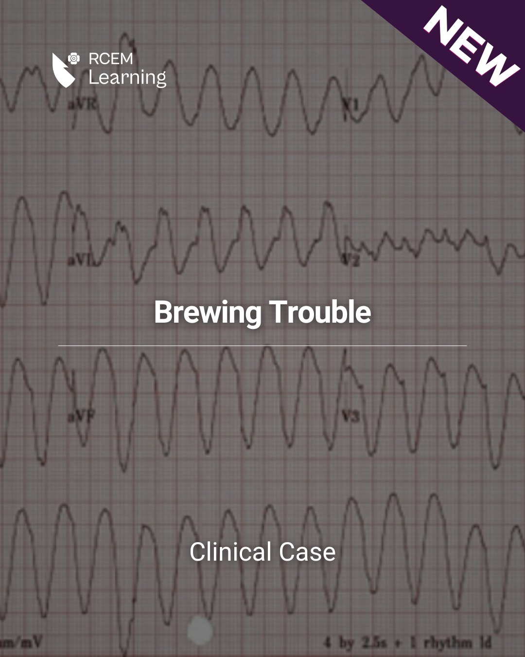 RCEMLearning - NEW: A female patient in her 50s’ presents... | Facebook