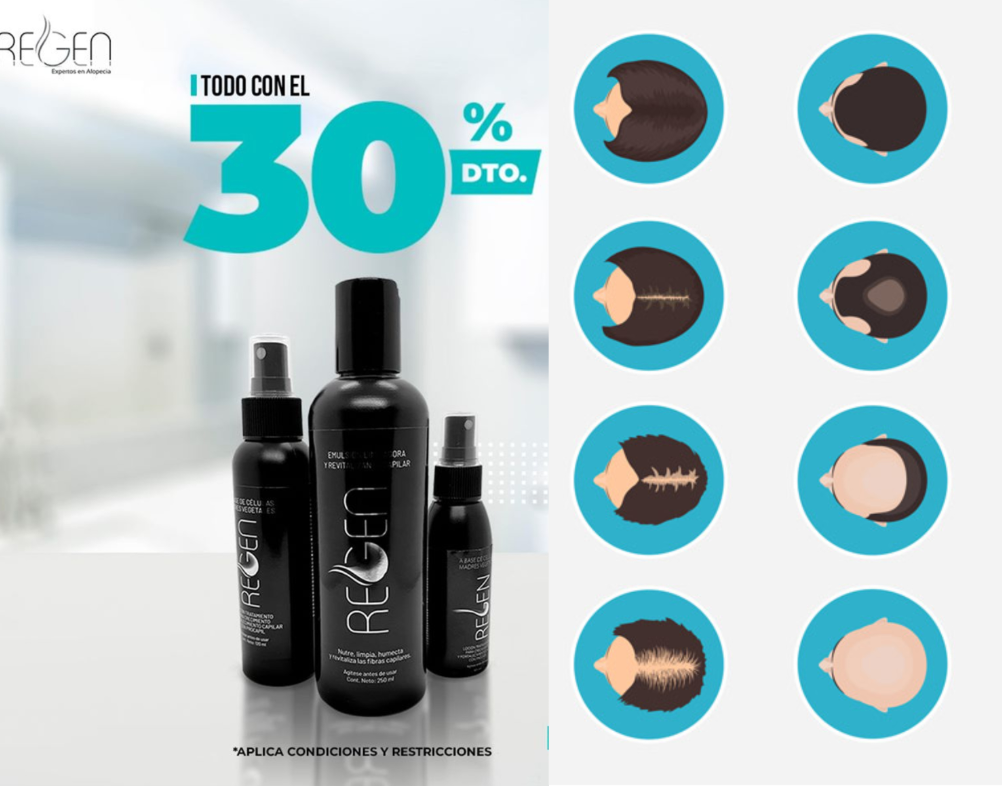 La caida del cabello es un... - REGEN Expertos en Alopecia