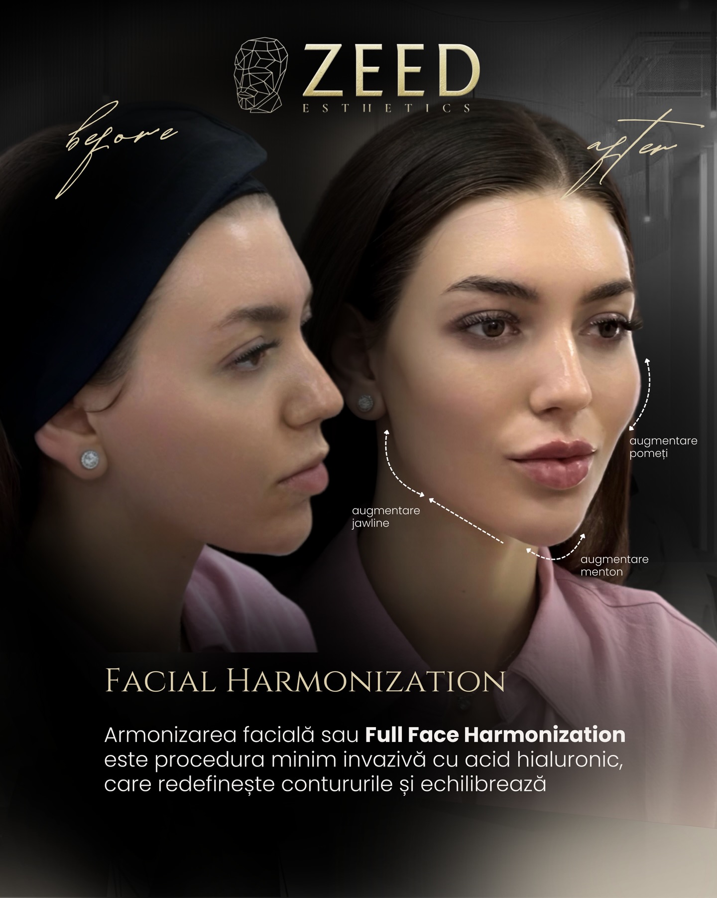 Dr.Hamudy Zeed - 💉 Procedure: Feminisation Package • Full... | Facebook