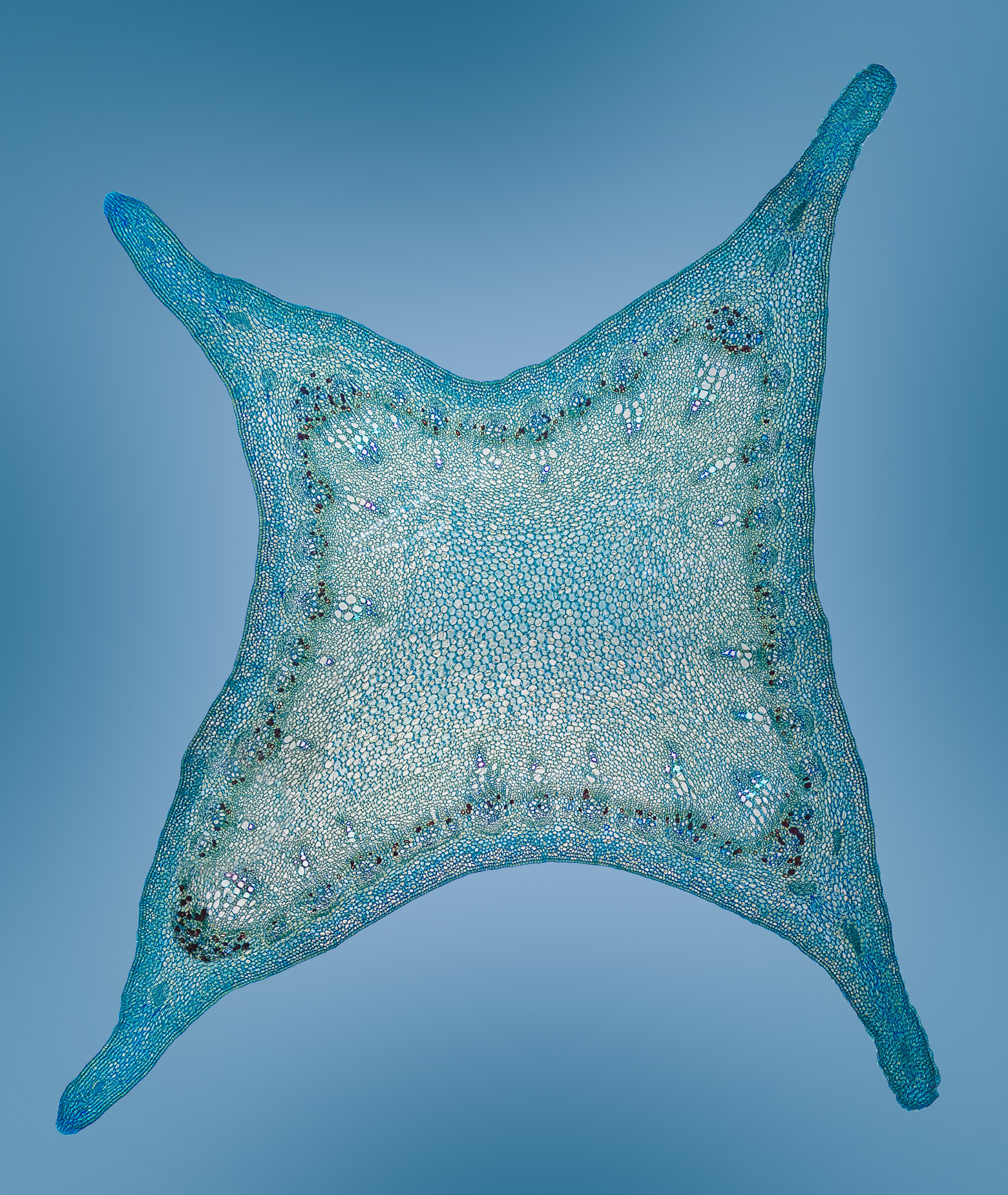 Amateur Microscopy | Fern prothallus—one of the specimens that I ...