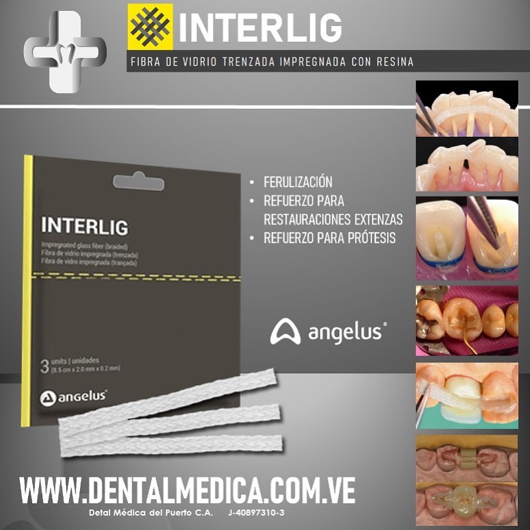 ⭐️ Interlig® ⭐️ Es un... - Dental Médica del Puerto