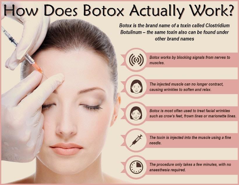 How does #Botox actually work? •••••••••• ☎️ Call us to schedule your ...