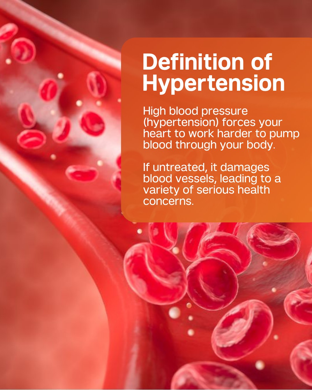 We often hear that high blood pressure causes heart disease, but it also puts extra strain on your heart and blood vessels. Over time, this increased pressure can damage your arteries and