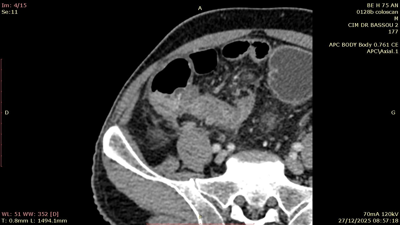 ‎Centre d'imagerie médicale Dr.BASSOU مركز طبي للتصوير بالأشعة‎ added a ...