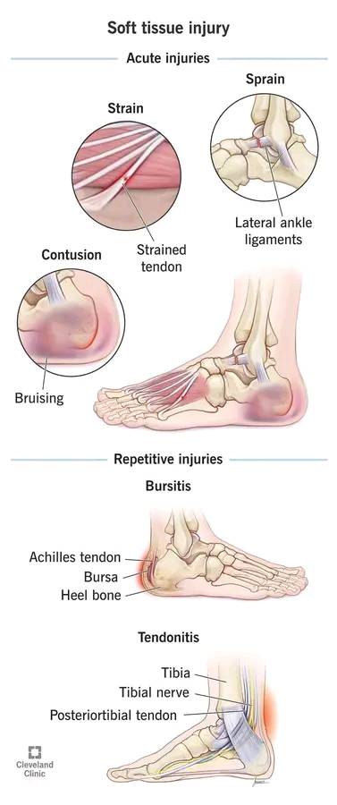 🔎 Understanding Soft Tissue... - DaisyKim Meton Sitima | Facebook