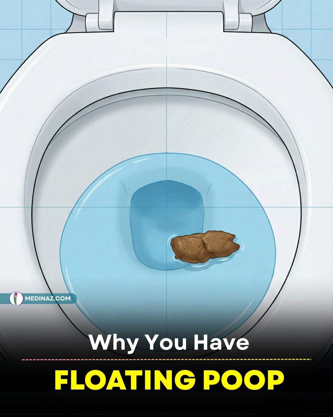 Medinaz - 🟣 Why You Have Floating Poop (Steatorrhea) Floating stool ...