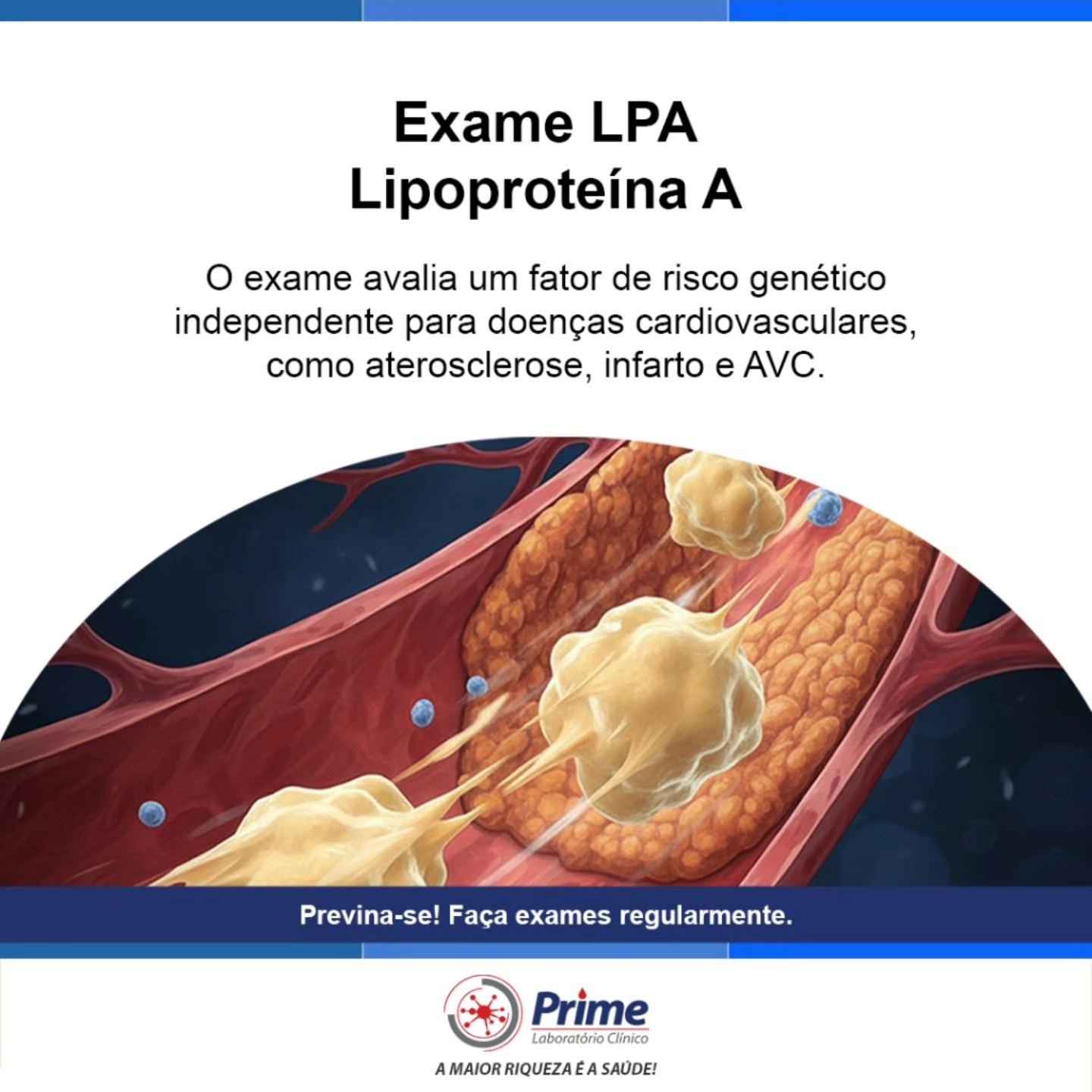 O que o Exame LPA tem... - Prime Análise Laboratório Clínico | Facebook