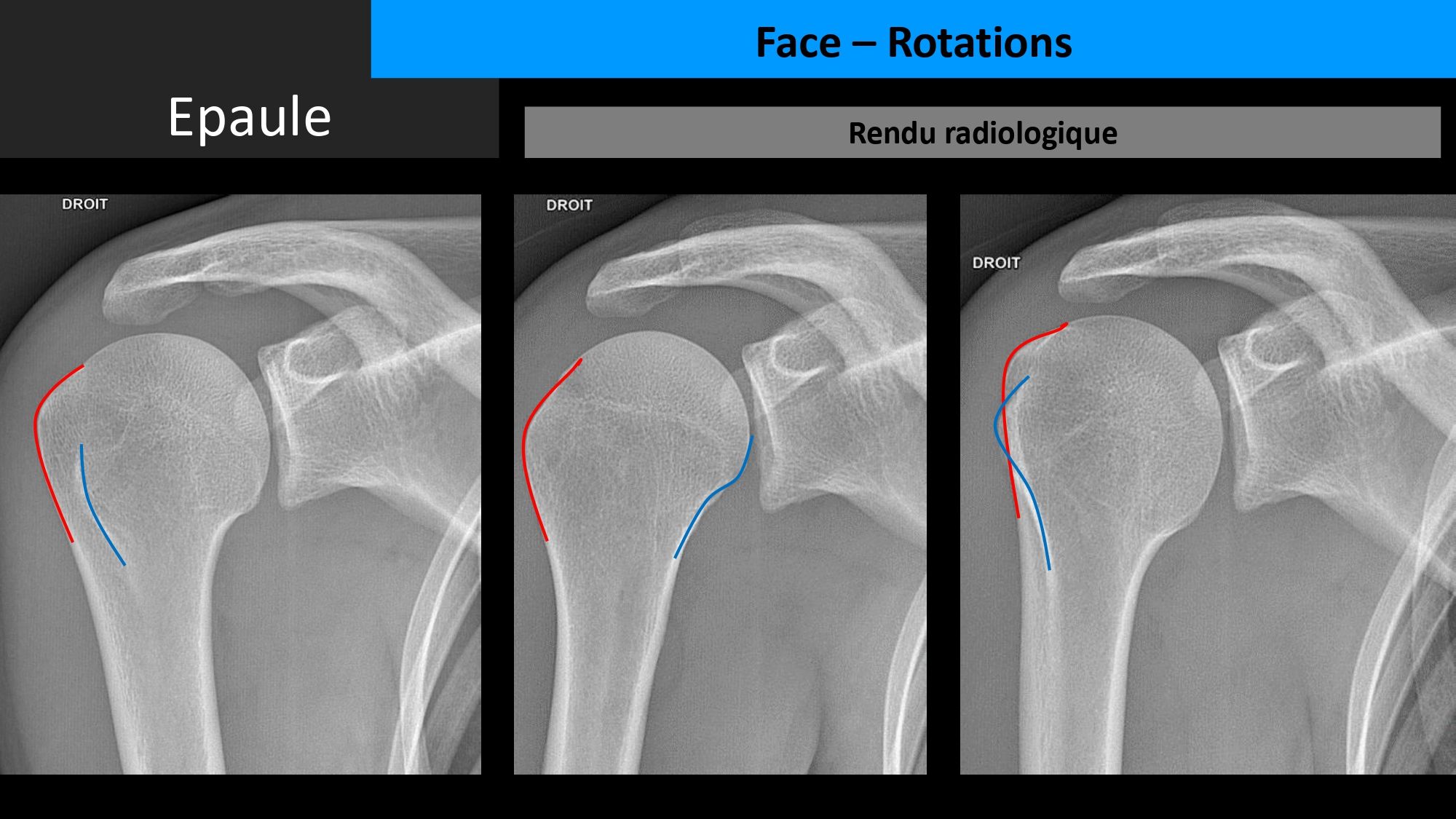 Association des jeunes techniciens en radiologie | brbi chkoun 9ra ...