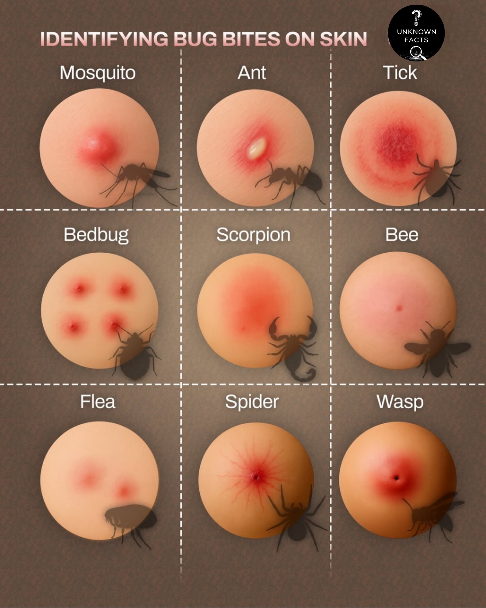 Unknown - Bug bites can often look similar, but knowing the small ...