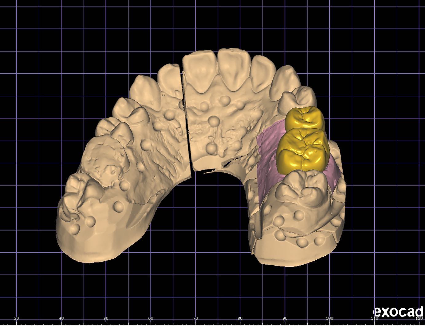 Moldent