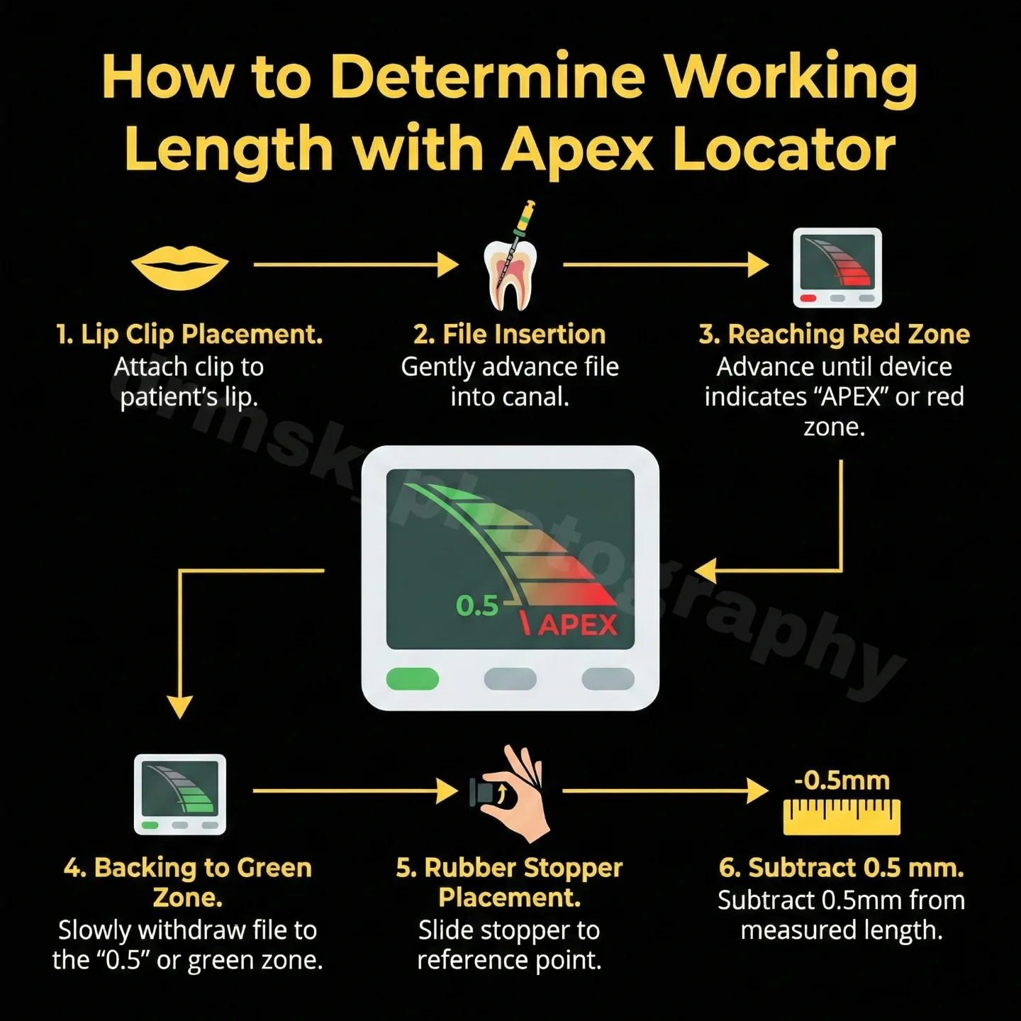 M S - Working Length Determination Made Simple- Accurate working length ...