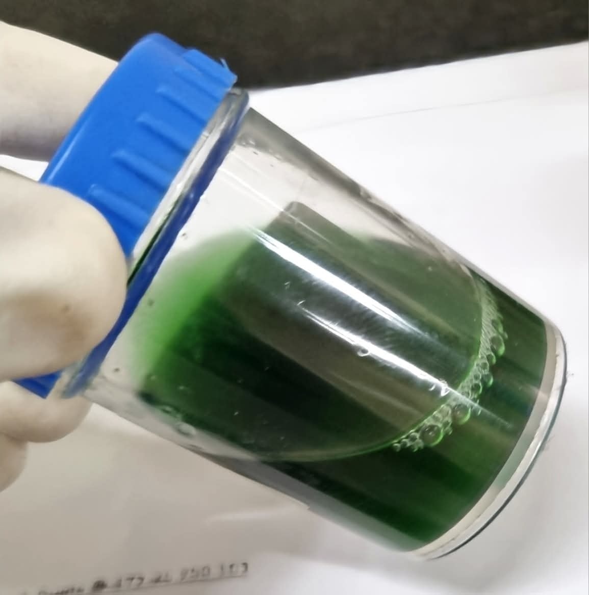 Green-colored urine can be caused by several factors. Here are the most common reasons: --- 🧪 1. Medications or Dyes Propofol (anesthetic) Amitriptyline (antidepressant) Cimetidine (acid reducer) Indomethacin (painkiller) Methylene blue or