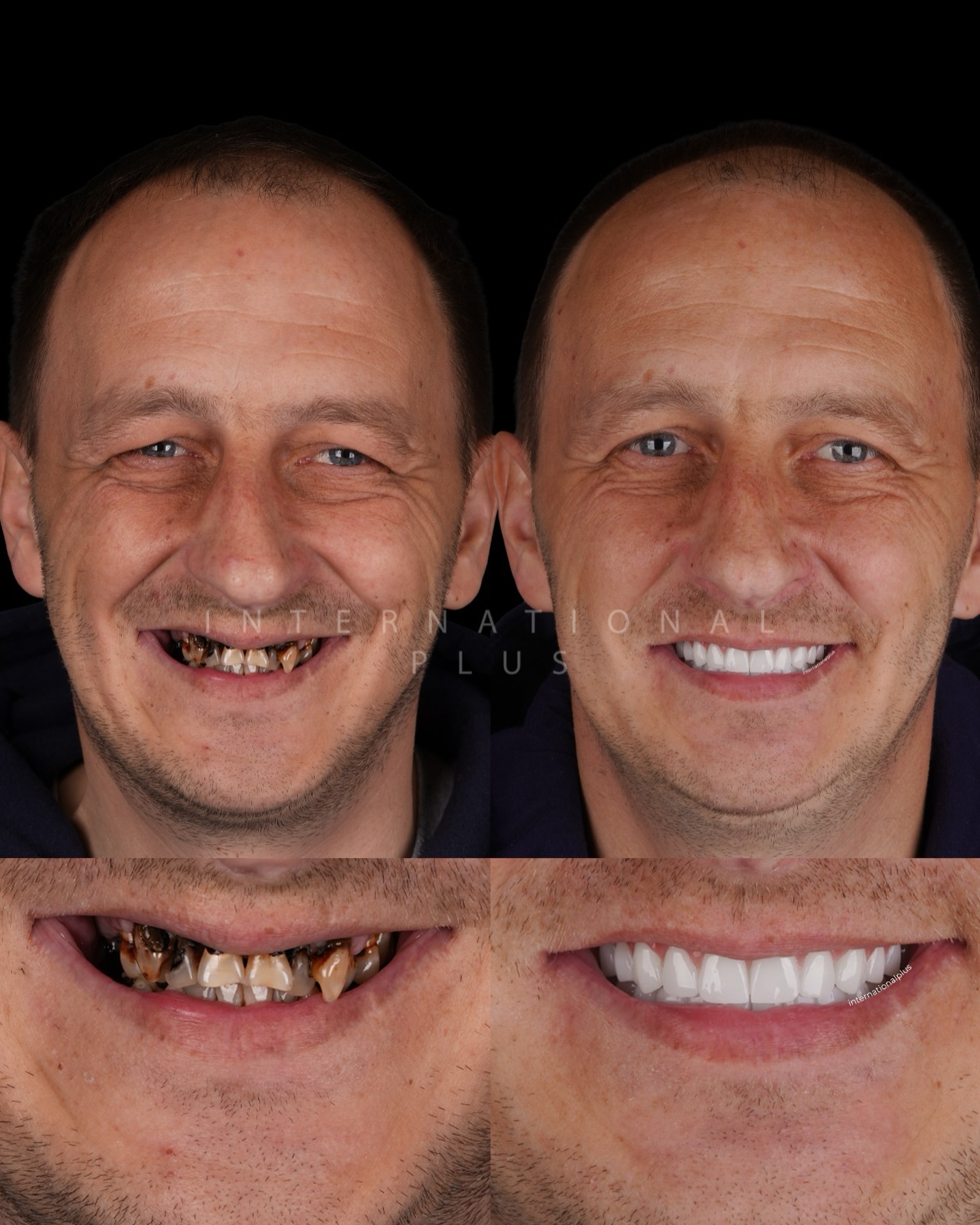 International - Before after pictures that show the difference ...