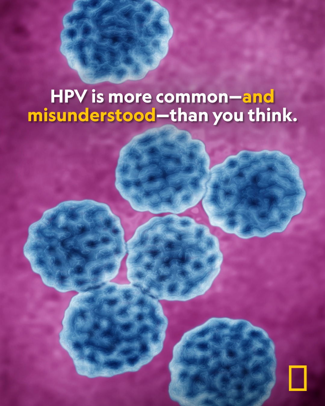 National - Human papillomavirus (HPV) is the most common sexually ...