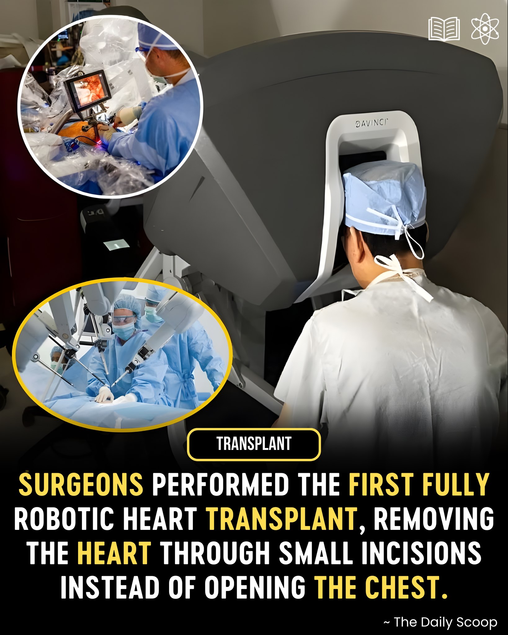 How robotics is transforming cardiac surgery