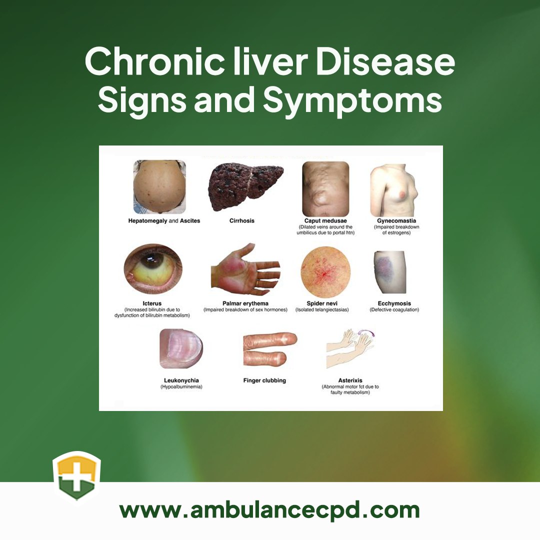 Ambulance CPD - Signs and symptoms of Aortic Dissection 📹... | Facebook