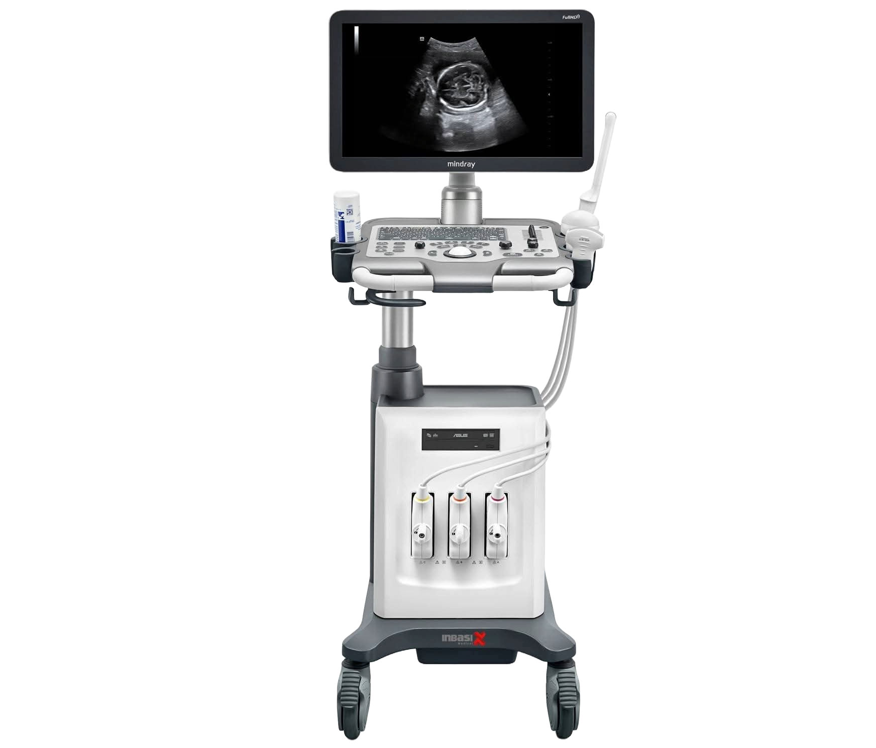 Digital Ultrasonogram Machine ডিজিটাল আল্ট্রাসনোগ্রাম মেশিন | Dhaka