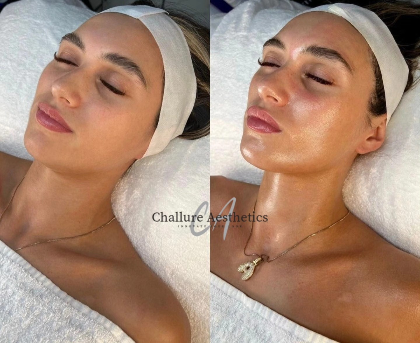 Challure Aesthetics | Maidstone
