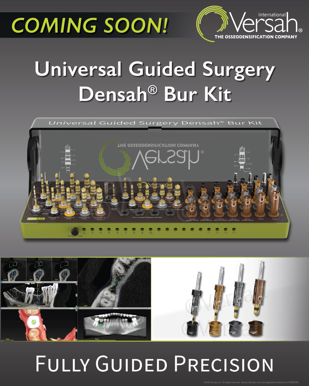 Versah UK | Shrewsbury