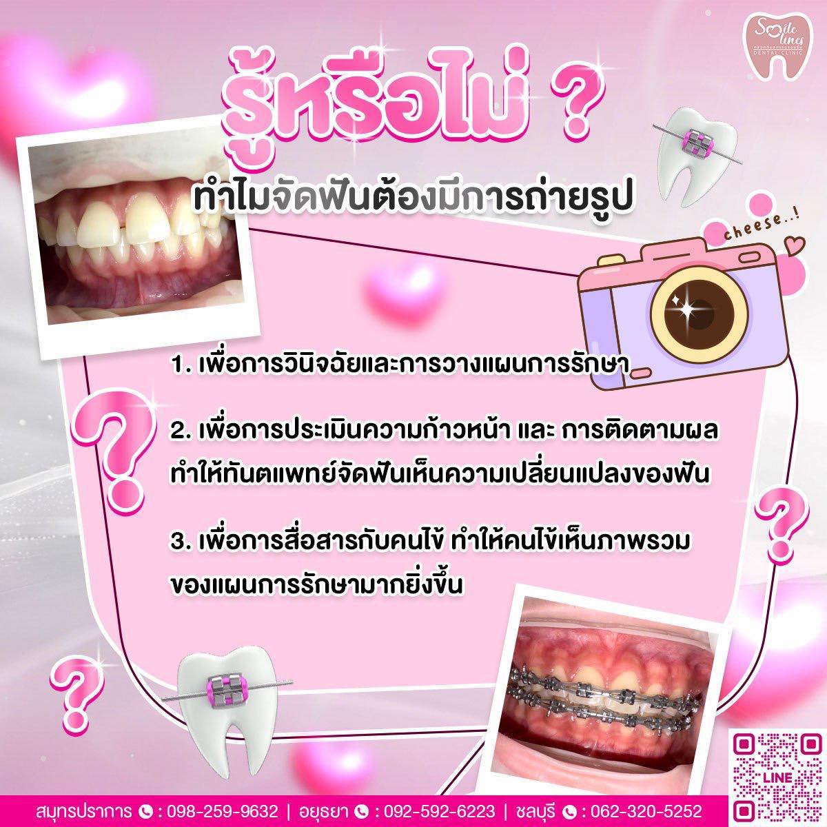 รู้... - คลินิกทันตกรรมรอยยิ้ม สาขา สี่แยกอุทัย-โรจนะ จ.อยุธยา | Facebook
