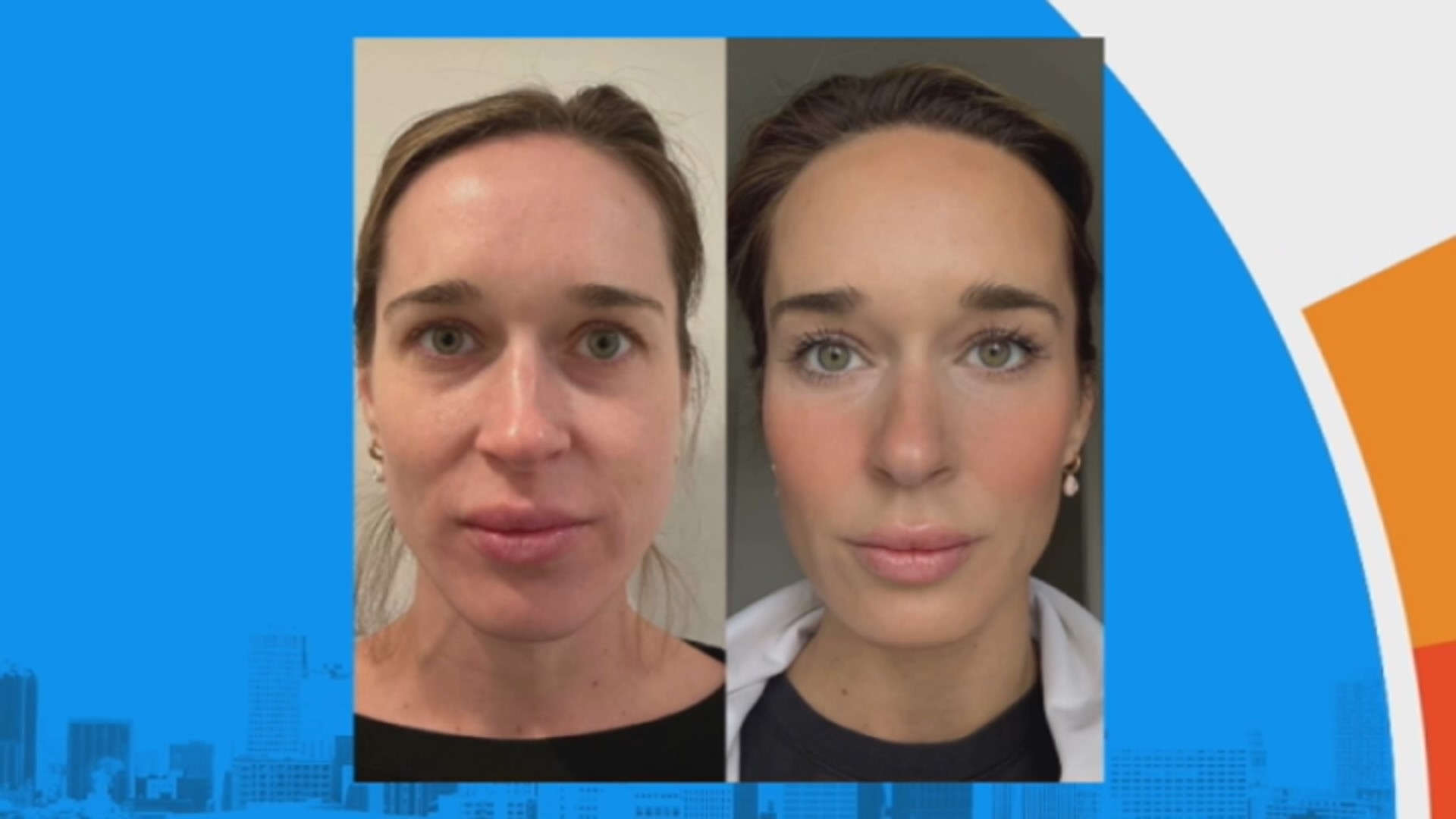 dr james skin whitening glutathione &amp Forget going under the knife 🧬 BPC-157: The Recovery spo-cs-disabled Size:200ml