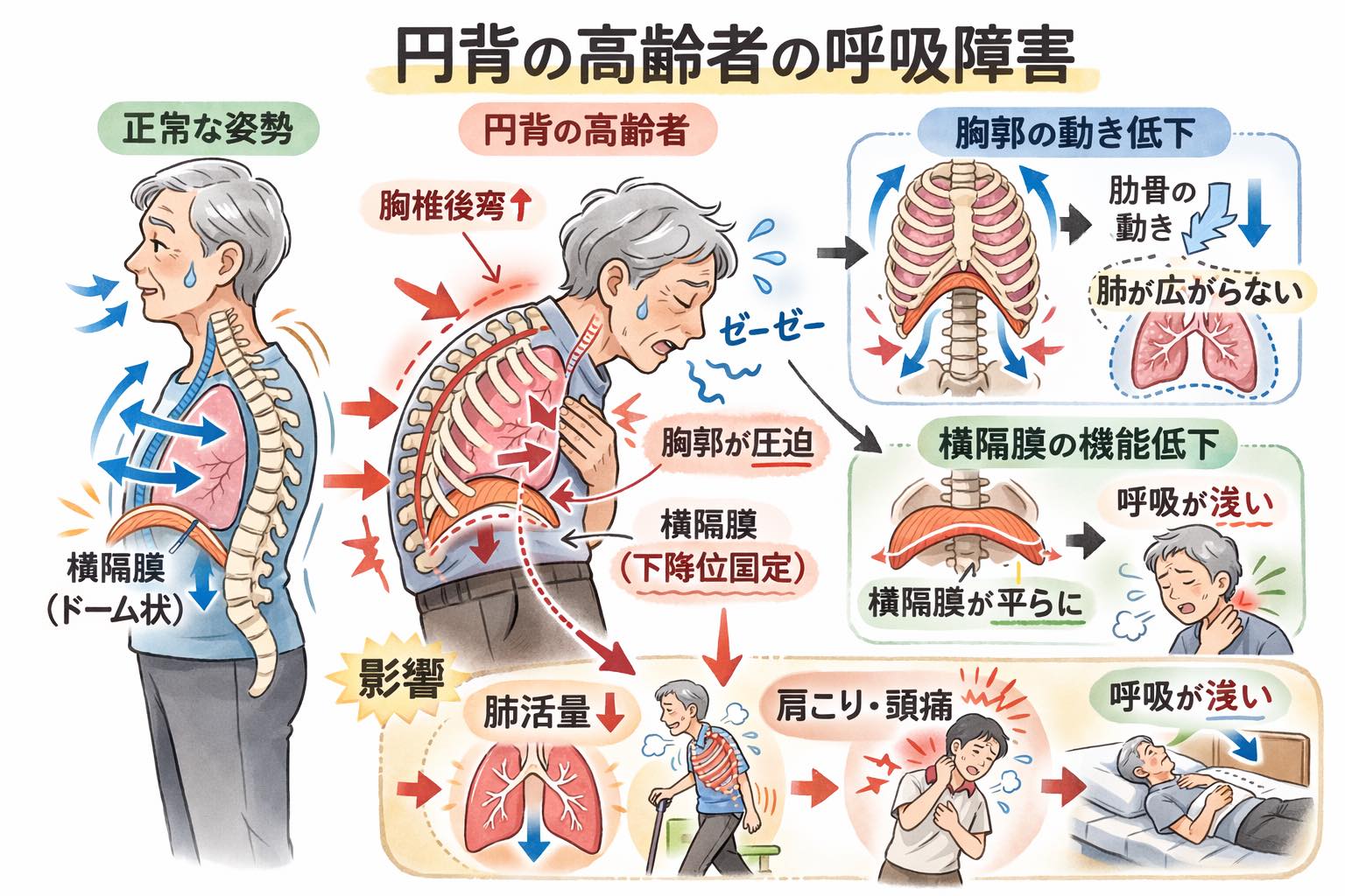 🟩 円背があると、なぜ呼吸が苦しくなるのか？... - BMT & Shinichiro ISHII | Facebook