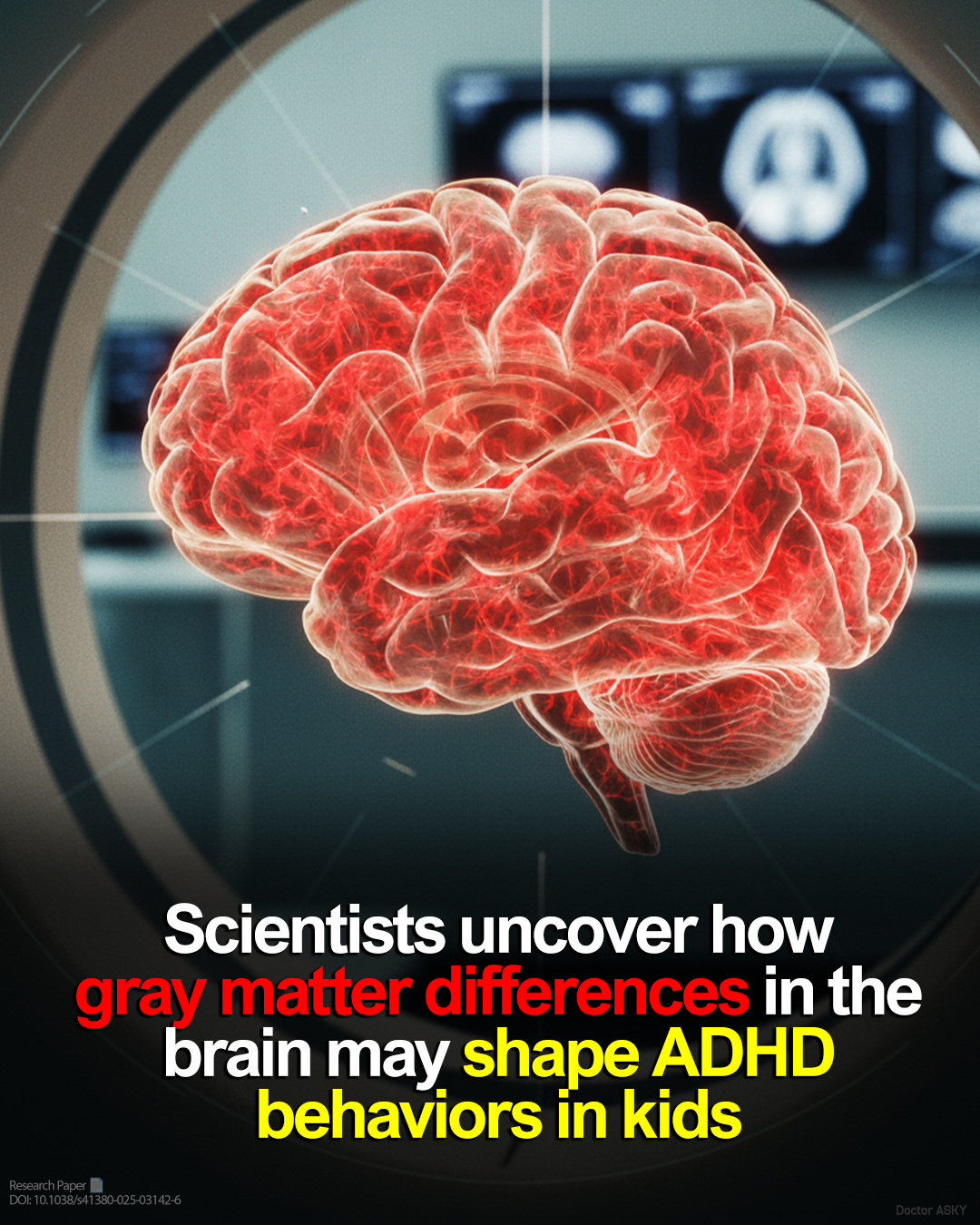 Doctor - A recent study has unveiled that children with ADHD exhibit ...