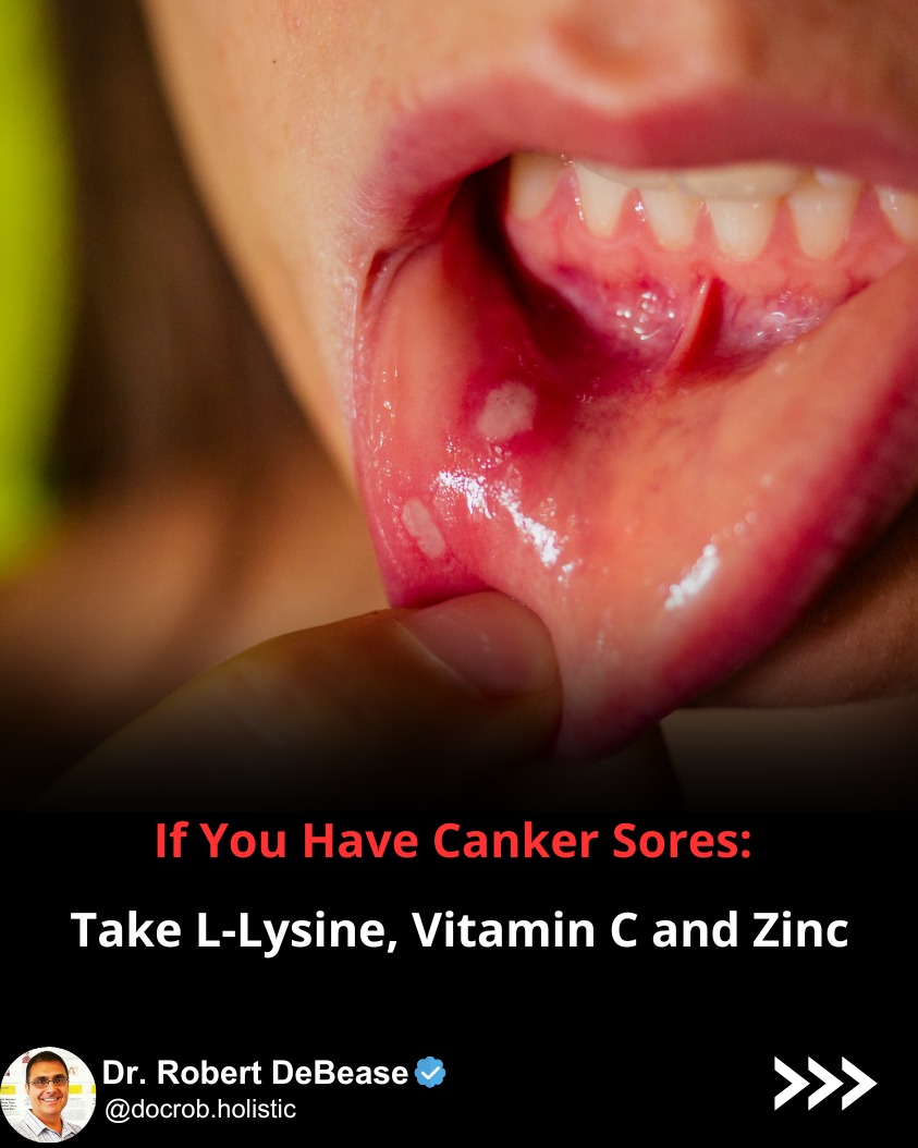 vitamin c deficiency chapped lips Dry Lips? Find Out Which Is Causing This Best Vitamins for Common Symptoms  Dry Lips Vitamin Deficiency: Nutrient