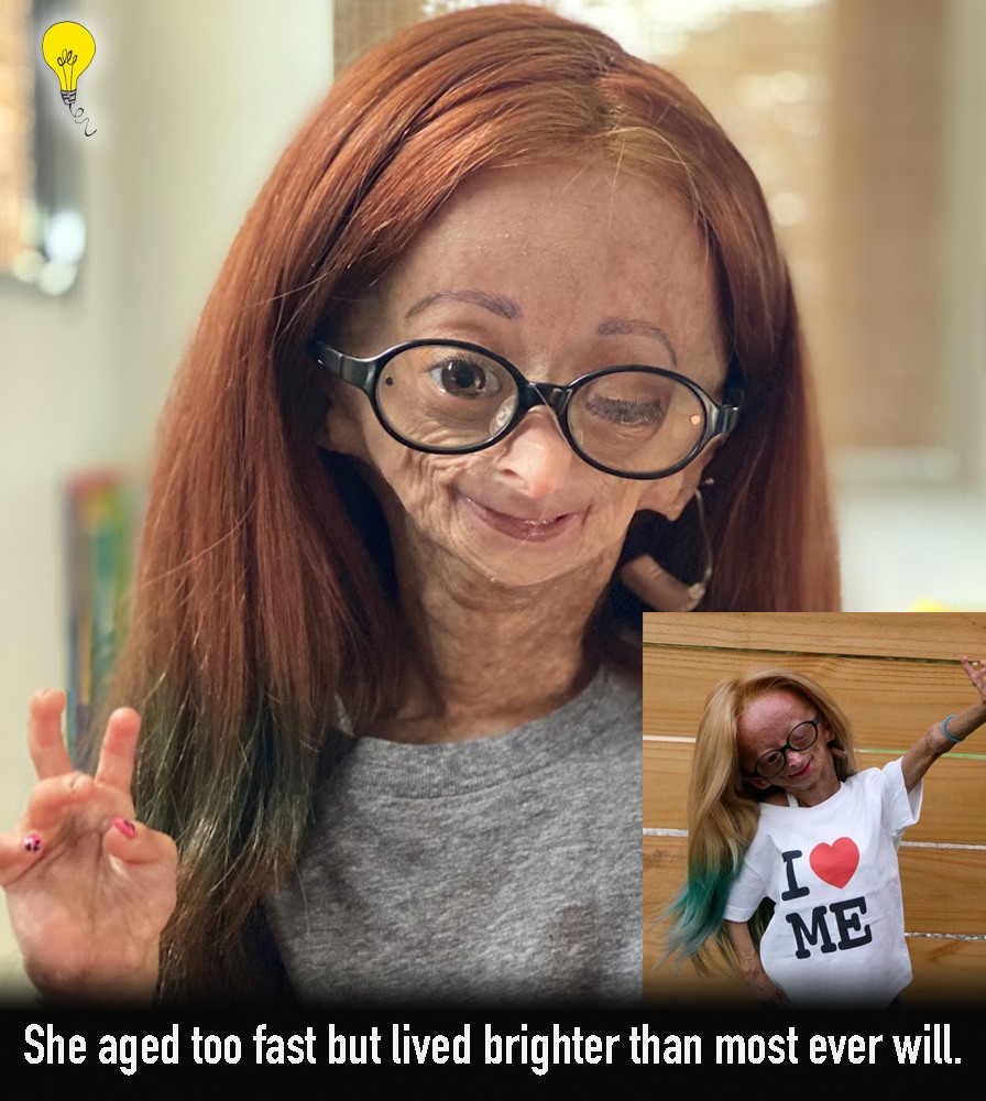 5 Unknown - 💜 The Girl Who Aged Too Fast — But Never Stopped Smiling ...